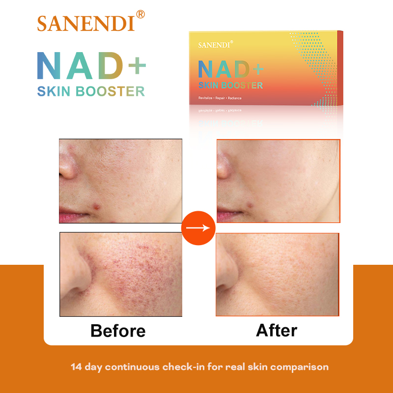 Sanendi NAD + Korea منتج العنا - مراجعة Korean Skincare Routine وسعره